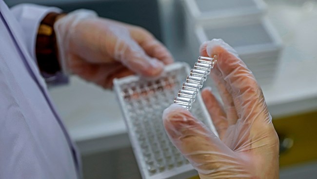 An Iranian biomedicine company has started mass production of serological test kits in the time of the new coronavirus pandemic.